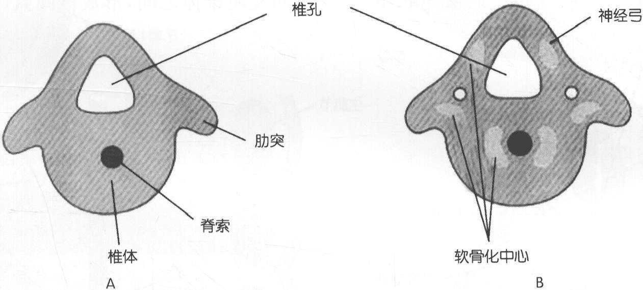 椎骨發(fā)育的軟骨期